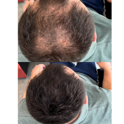 Scalp Concealer for Fuller, Natural-Looking Hair (BUY 1 GET 1 FREE)